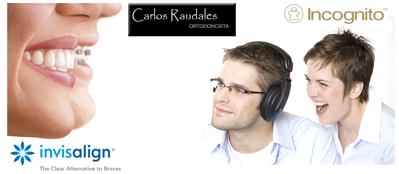 Invisalign-Incognito